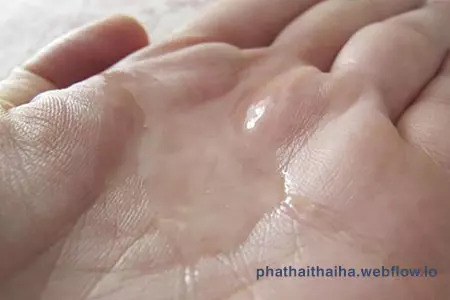 Ra nhiều khí hư loãng như nước khi mang thai